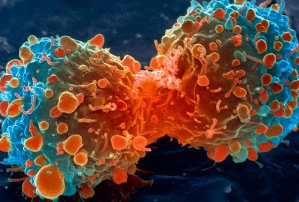 Inmunoterapias combinadas contra el cáncer de pulmón