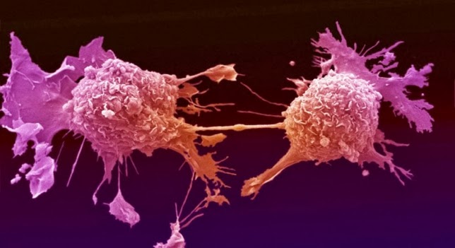 Diseñan un parche en la lucha contra el cáncer de colon