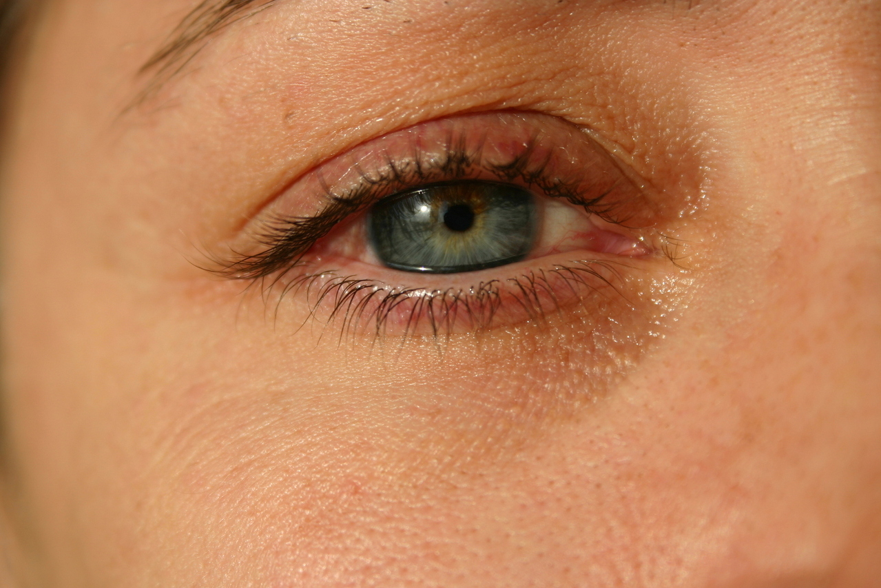 Tengo el ojo rojo: ¿será conjuntivitis?